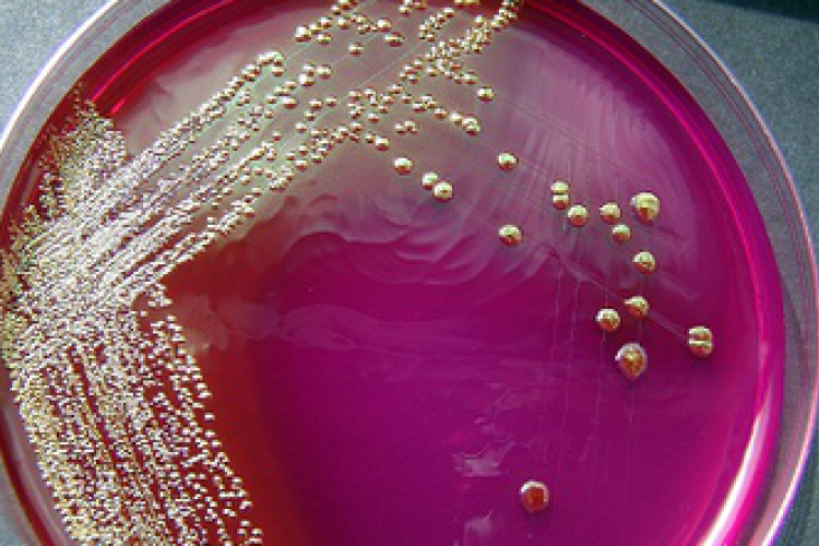 Az új kórokozók kihívást okoznak a szakembereknek