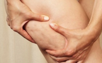 Varázslatos olajkeverék narancsbőr ellen!