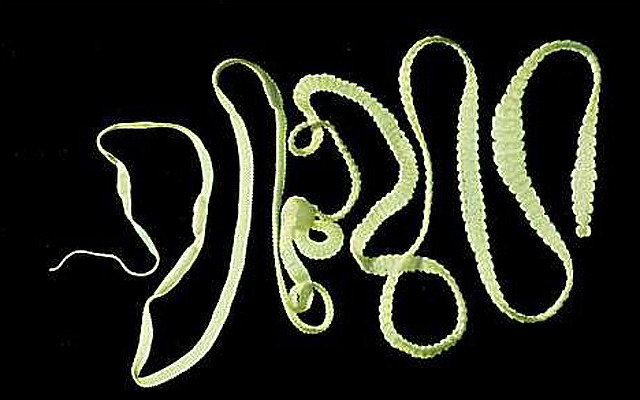 Fogyással harcol a szervezet a bélférgek ellen