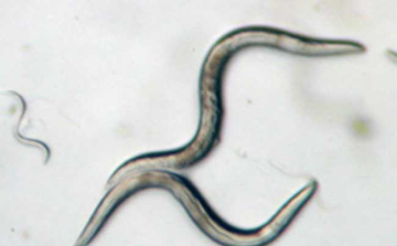 Szívférgesség: a fonálféreg számára az ember nem a megfelelő gazda