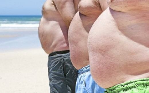 Diszkriminálják az orvosok a kövéreket?