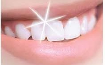 Fogfehérítés házilag